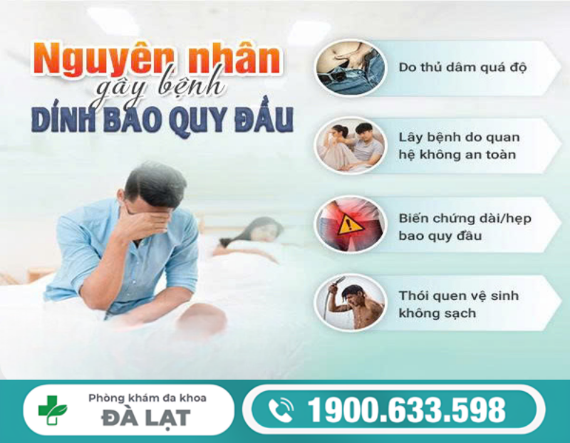 Hình ảnh minh họa